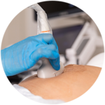 échographie mobile ehpad